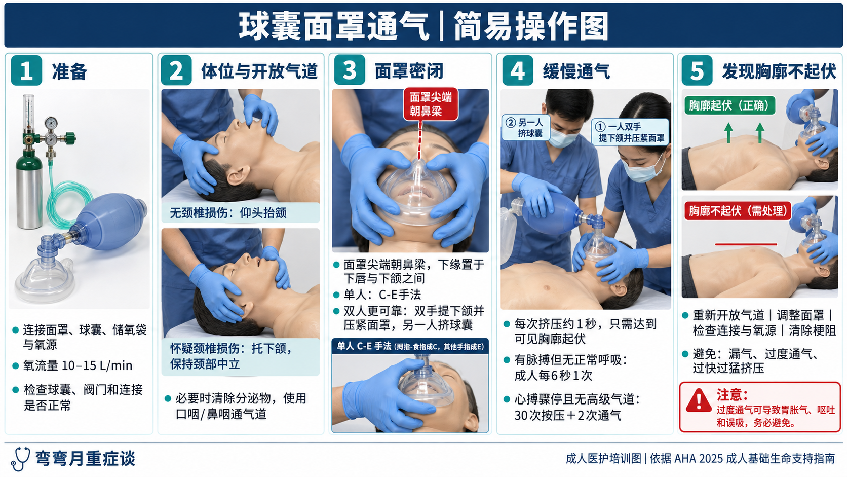 球囊面罩通气操作图